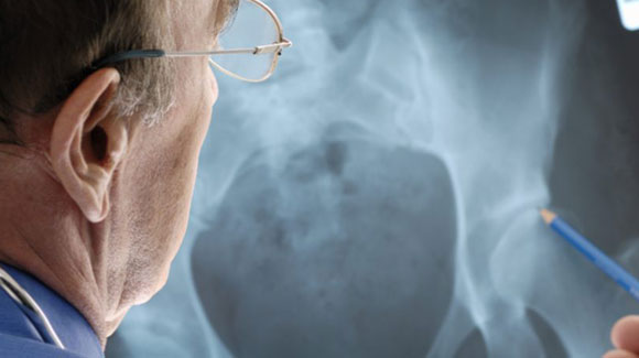 OrthoForum Members Discuss Direct Anterior Approach for THA is the future